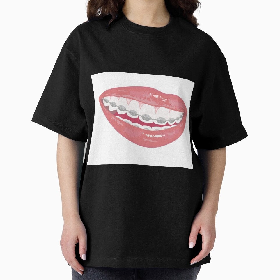 Braces by Sipsta